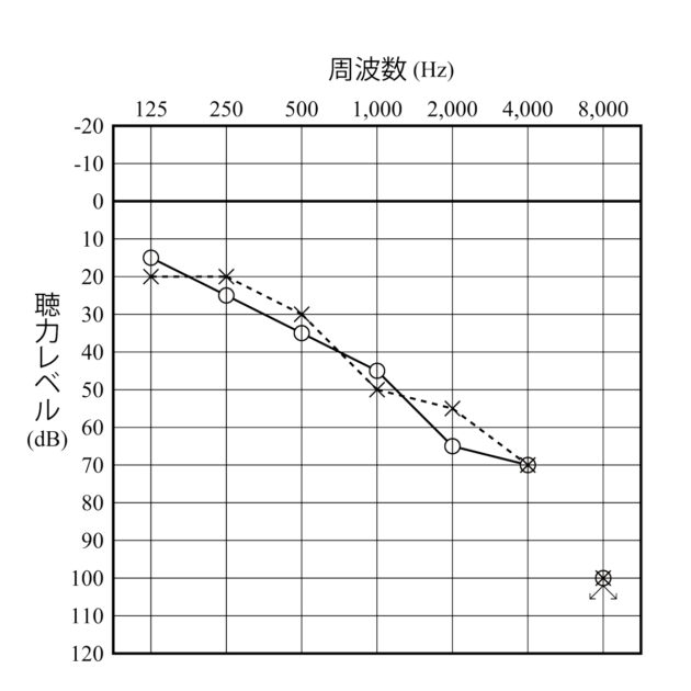 本人のオージオグラム（作成：2023.1
）